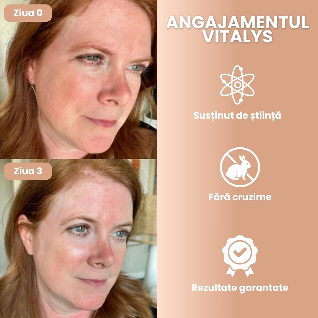 Vitalys - Bio Collagen Face Mask